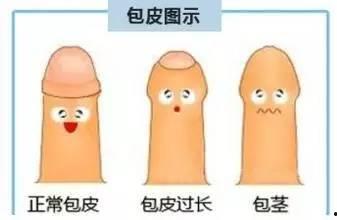 割包皮手术视频全过程,专业视角下的手术过程解析